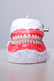 Постановка искусственных зубов в воске, полные съемные протезы верхней и нижней челюсти